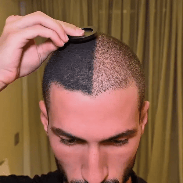 LOVILDS™ Hair Density Filler