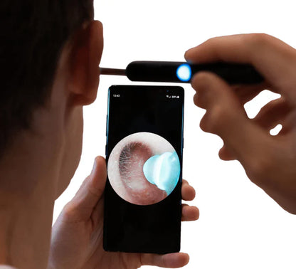 Safe, Gentle, and Clear – Visual Earwax Remover