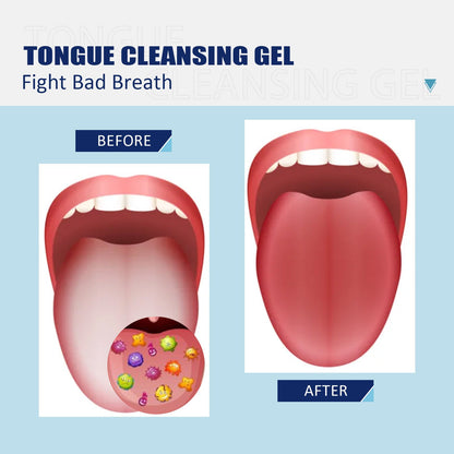 Tongue cleaning gel with brush🔥Discounts you won't believe🔥